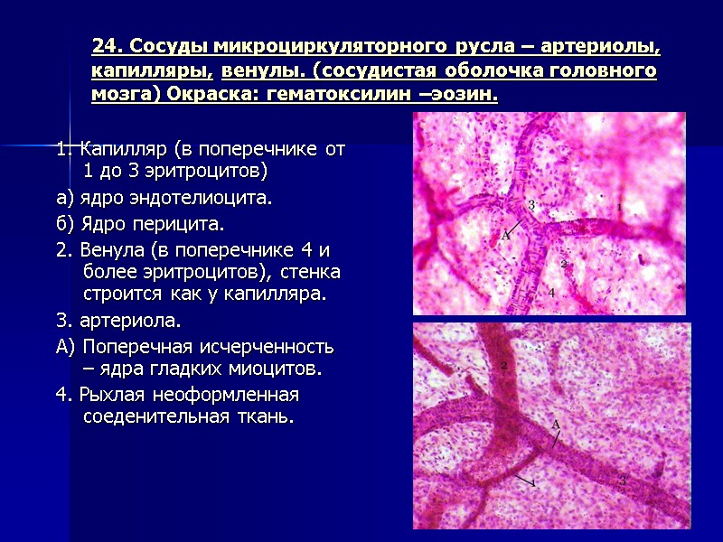 24. Сосуды микроциркуляторного русла – артериолы, капилляры, венулы. (сосудистая оболочка головного мозга) Окраска: гематоксилин